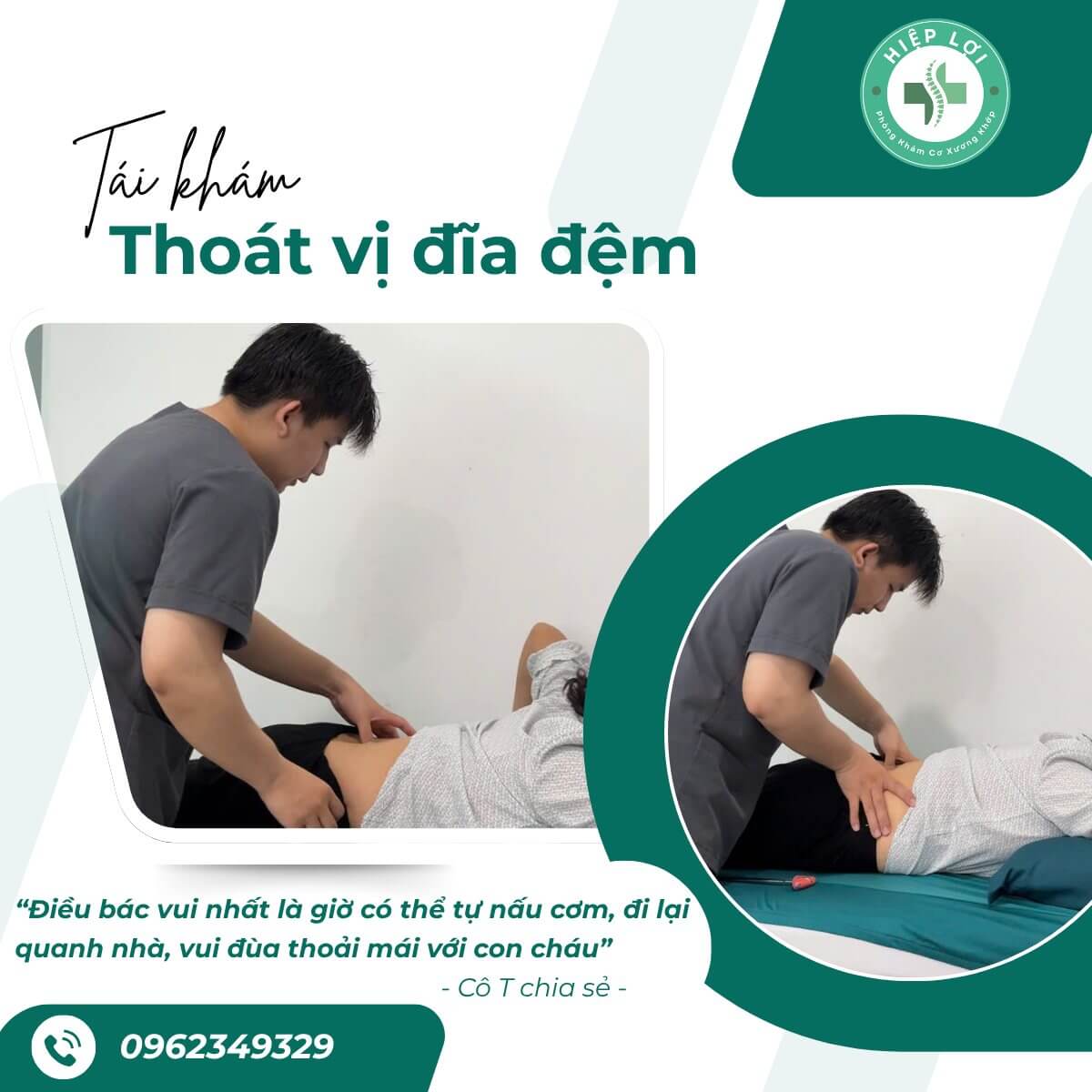 Đau lưng lan xuống mông và chân