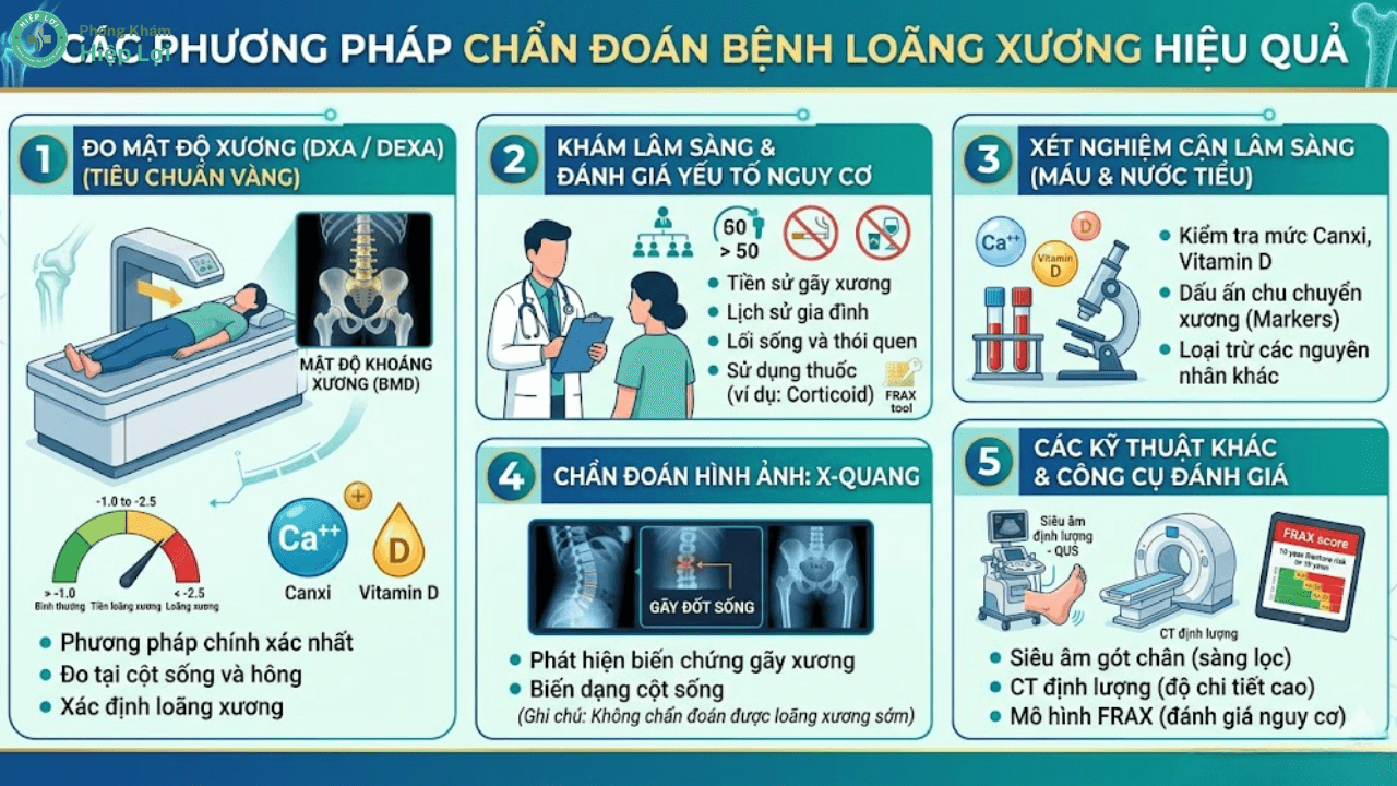 Tổng Quan Các Phương Pháp Chẩn Đoán Bệnh Loãng Xương - Phòng khám Hiệp Lợi