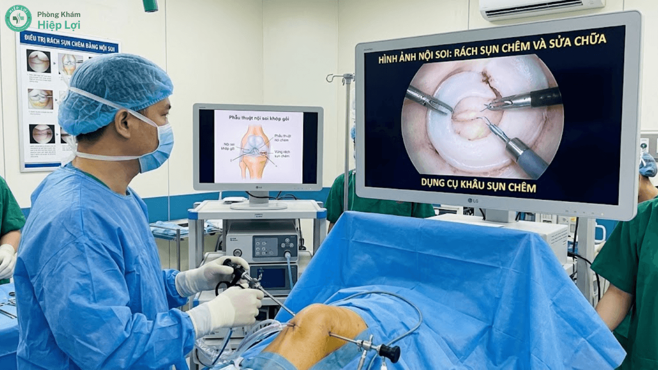 Điều Trị Rách Sụn Chêm Khớp Gối Và Phục Hồi Chức Năng - Phòng khám Hiệp Lợi