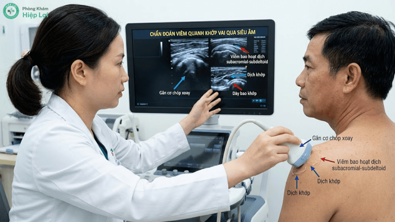 Cảnh Báo: Những Đối Tượng Nào Có Nguy Cơ Bị Viêm Quanh Khớp Vai Cao Nhất? - Phòng khám Hiệp Lợi
