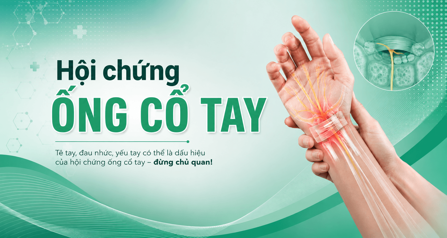 Tìm hiểu về hội chứng ống cổ tay
