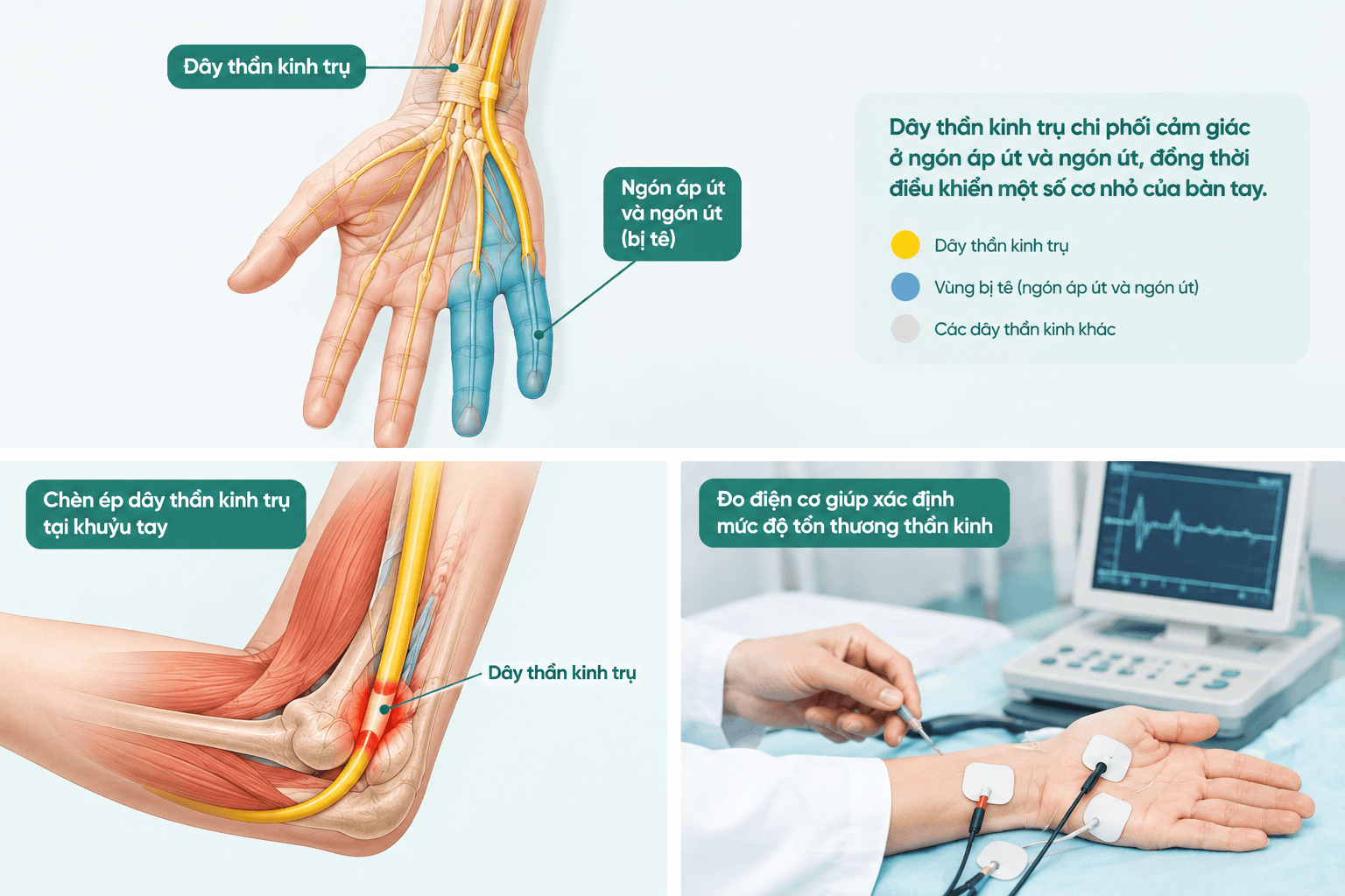 Tê Ngón Áp Út Và Ngón Út: Nguyên Nhân, Cách Điều Trị Và Khi Nào Cần Đi Khám? - Phòng khám Hiệp Lợi