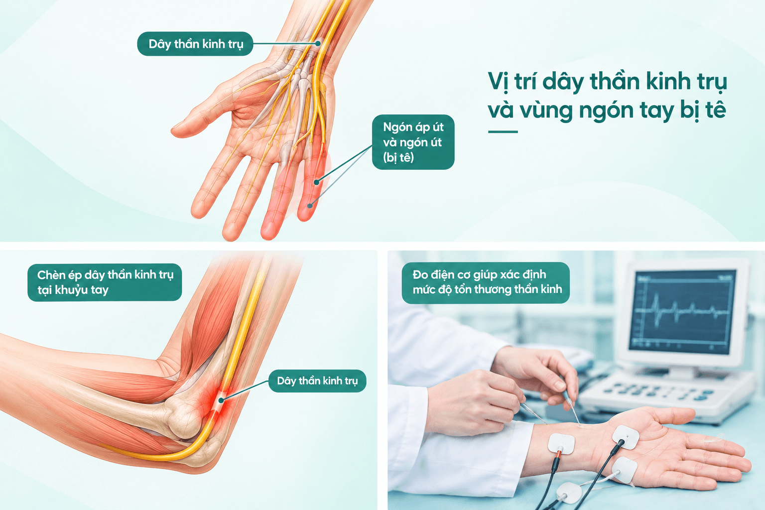 Tê Ngón Áp Út Và Ngón Út: Nguyên Nhân, Cách Điều Trị Và Khi Nào Cần Đi Khám? - Phòng khám Hiệp Lợi