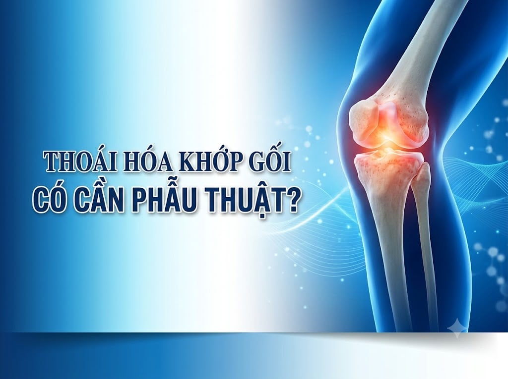 THOÁI HOÁ KHỚP GỐI - CÓ CẦN PHẪU THUẬT